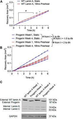 Progerin-Induced Impairment in Wound Healing and Proliferation in Vascular Endothelial Cells